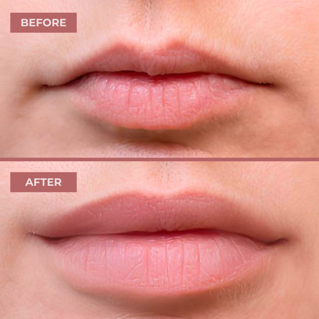 GlowPump Lips | Instant Volumizing Shot